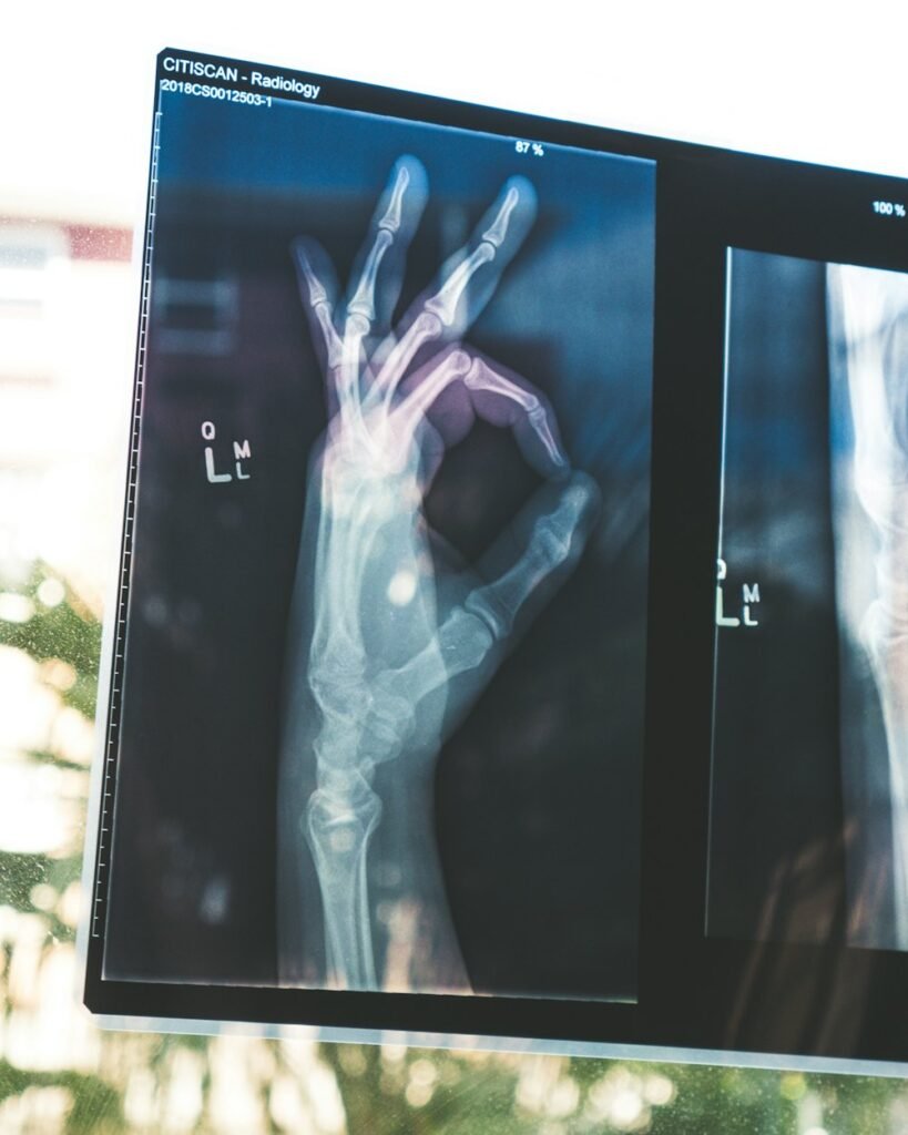 Digital X-Ray